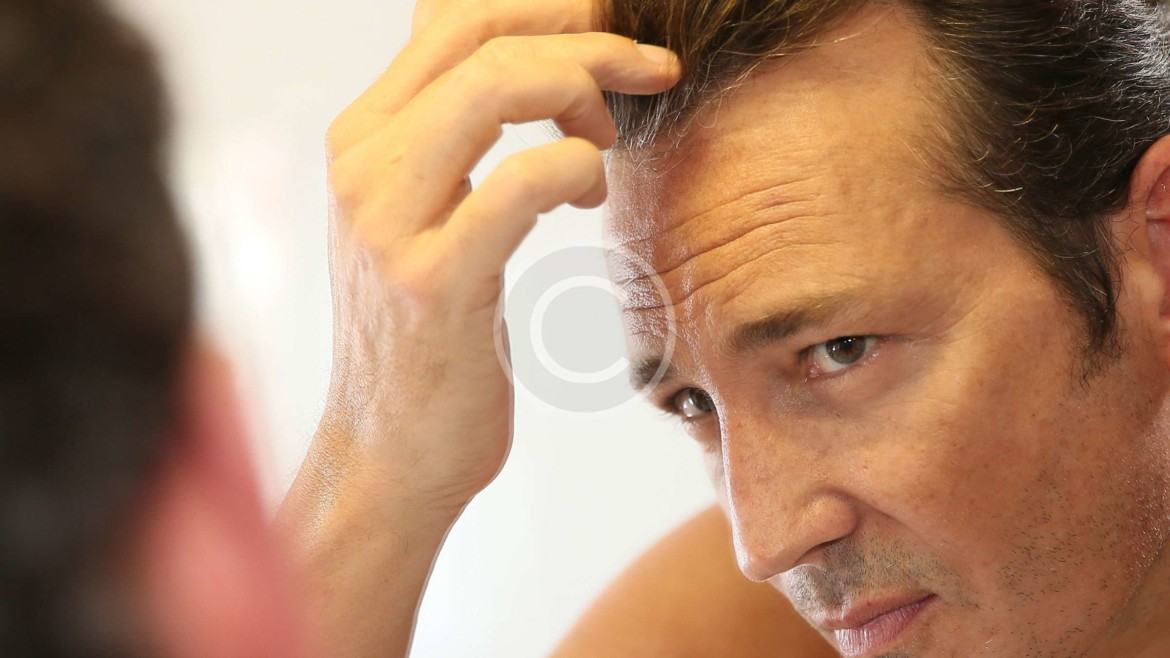 Laser Hair Loss Therapy